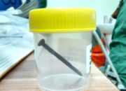 Ngeri! Pria Paruh Baya Tertelan Paku Saat Memperbaiki Jendela Kamar Putrinya